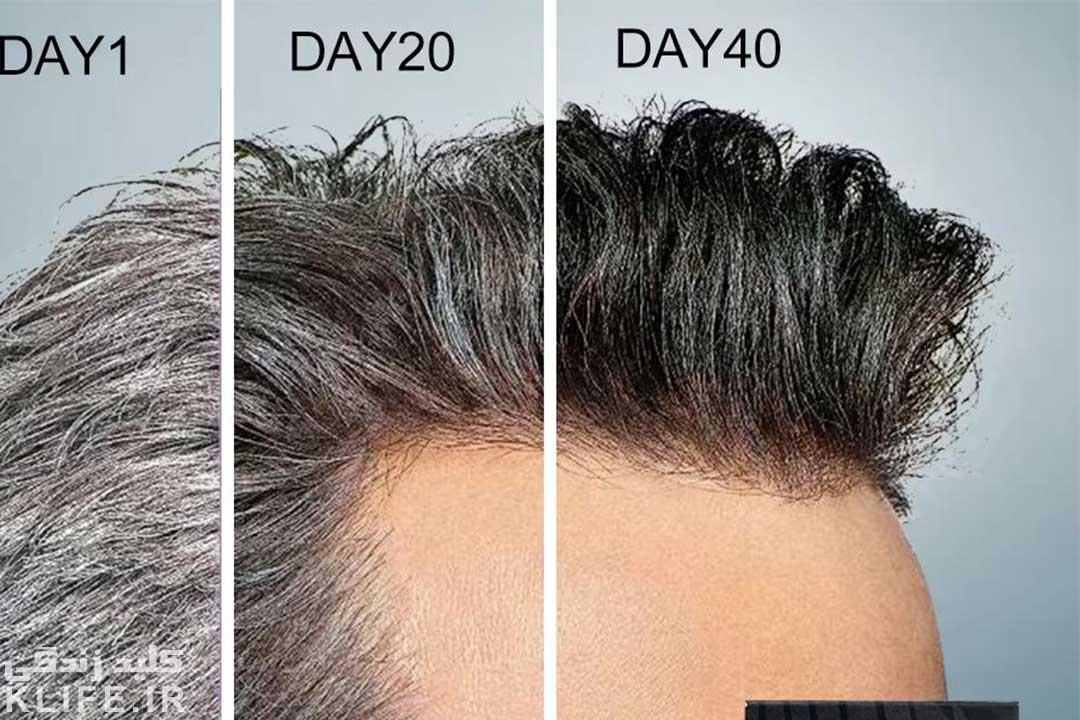علل سفیدی مو و راه های پیشگیری و درمان آن - کلید زندگی